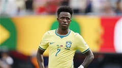 Vinicius gây sốt với diện mạo khác lạ sau phẫu thuật thẩm mỹ