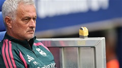 Vì sao Mourinho xuất hiện với vết bầm tím quanh mắt?